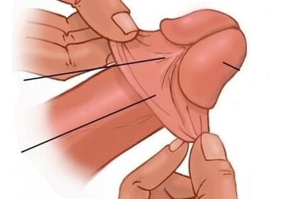 главата на пениса и неговото уголемяване